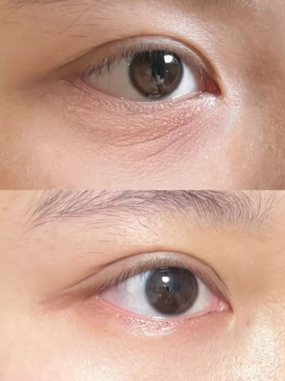 露卡菲娅小蓝瓶淡纹眼霜：口碑出圈破圈成长，国货淡纹新势力崛起正当时