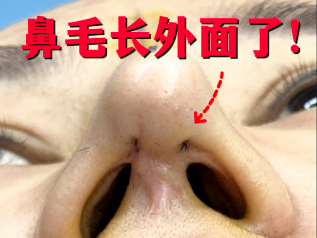如何正确去鼻毛？鼻毛修剪器哪个牌子好？口碑最好的鼻毛器推荐2026