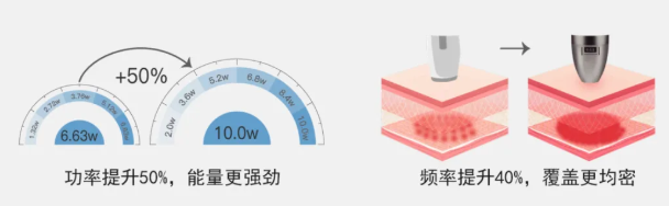 别被年龄数字框住：何时该做大超炮？低头看看这4个衰老信号