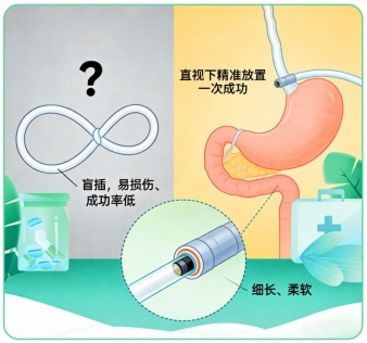 北京精诚博爱医院：临床营养在行动，可视化鼻肠管与肠内营养支持