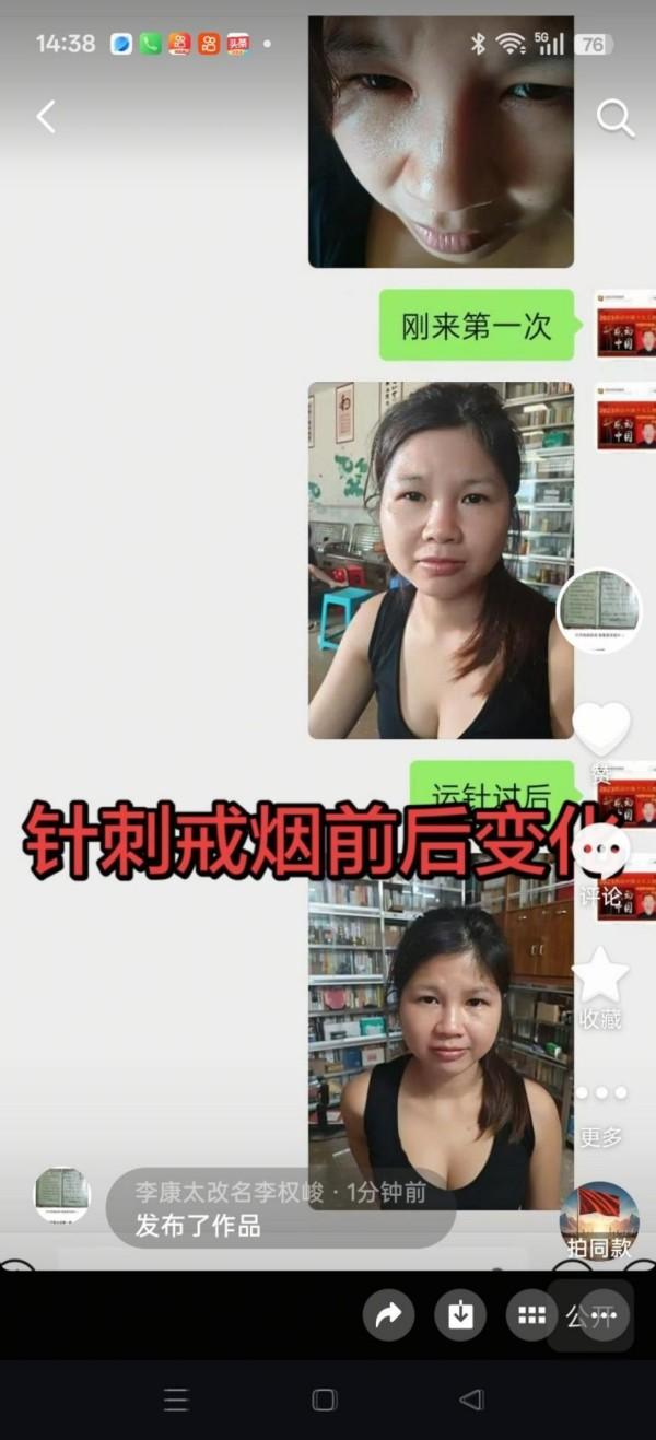 我问A1，再世华佗否是真？