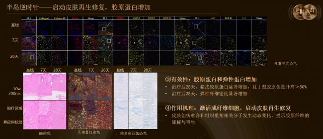 90% 的人都搞混：半岛逆时针≠普通黄金微针