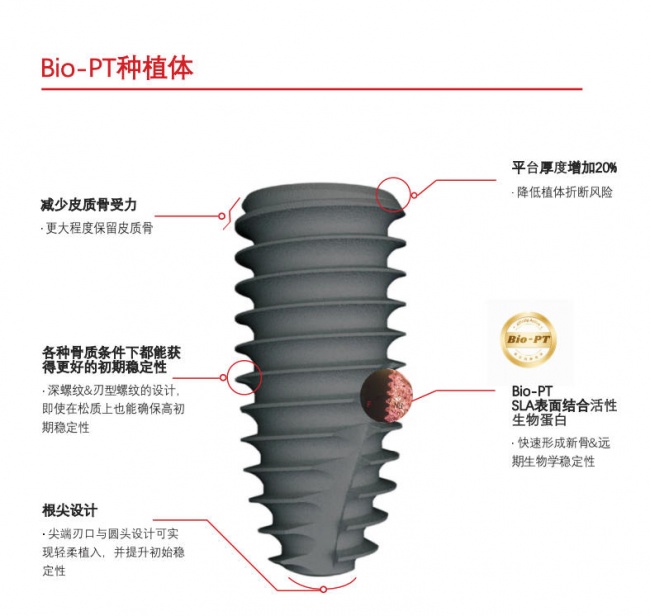 缺牙修复新选择:NTAoss种植体适配多种口腔情况 缺牙修复新选择:NTAoss种植体适配多种口腔情况