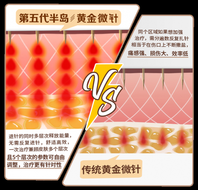 半岛逆时针又舒适又精准的底气从哪来？贵在底层技术