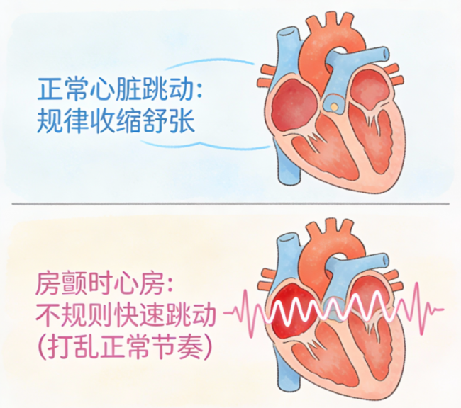 可降解封堵器：为老年心脏介入治疗留一条“后路”