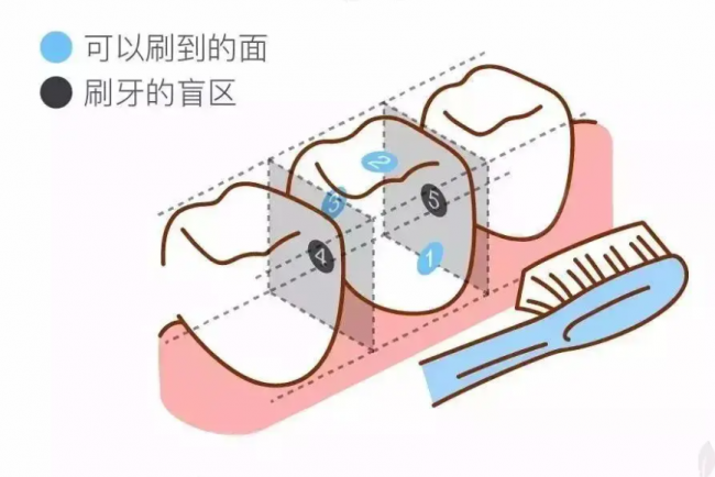 刷牙总出血，别再怪&上火&了