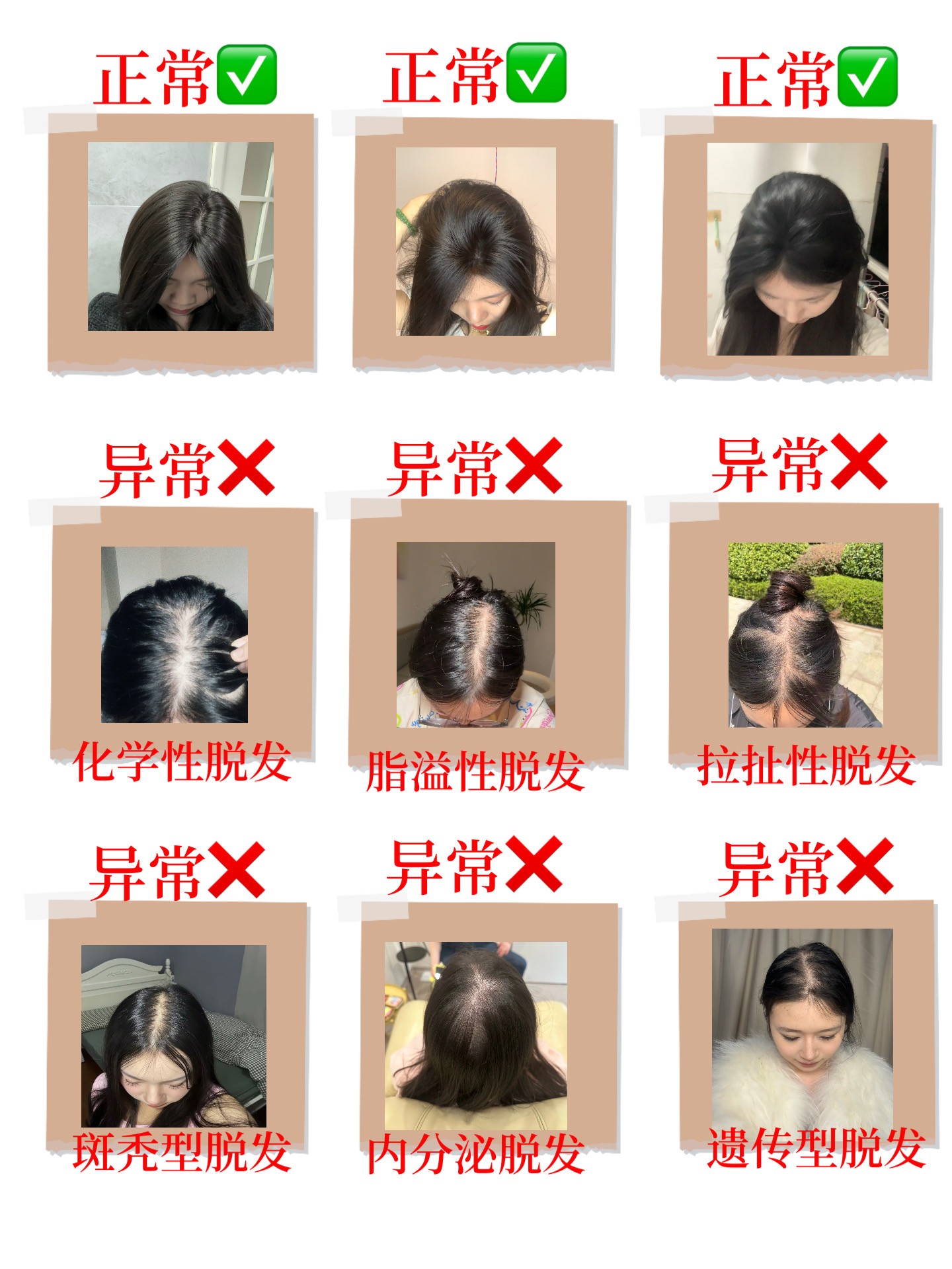 生发液哪个牌子育发效果好？十分敏皮防脱安心产品，不冲大亏！