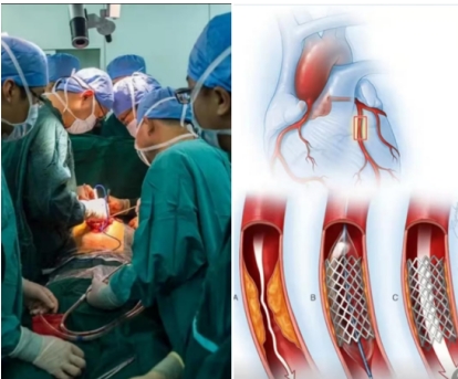 冠心病到底 能不能彻底痊愈?养生素发明成功挑战不可能! 冠心病到底 能不能彻底痊愈?养生素发明成功挑战不可能!