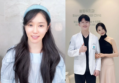 韩综《我是单身》嘉宾Lee Nara 公开美齿治疗笑容更有魅力！
