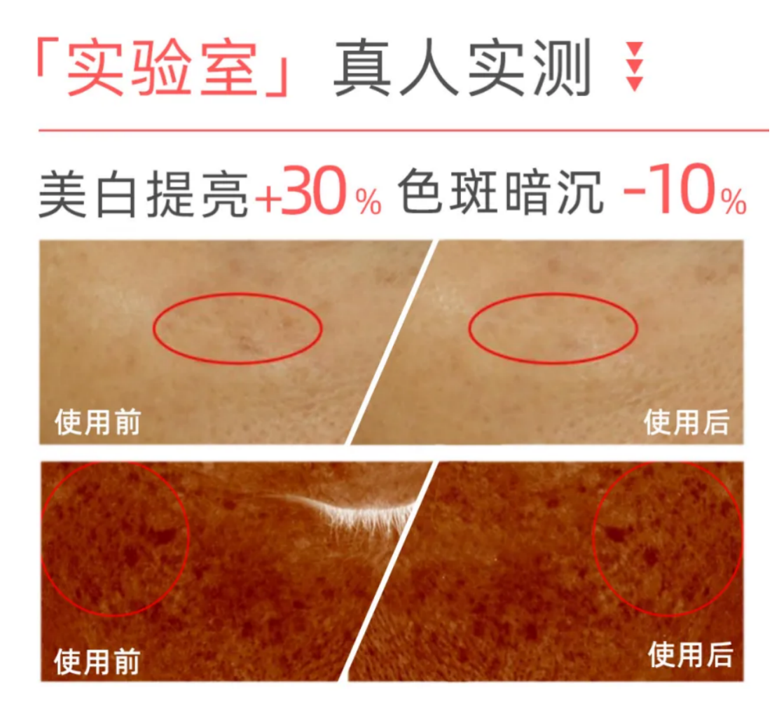 科学护肤×精准焕亮：子菁光速亮白舱专研色沉肌护理方案