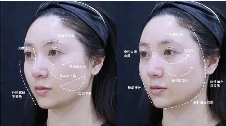 皮肤“危肌”预警！干燥、松垮、下垂...如何破？杏林医美