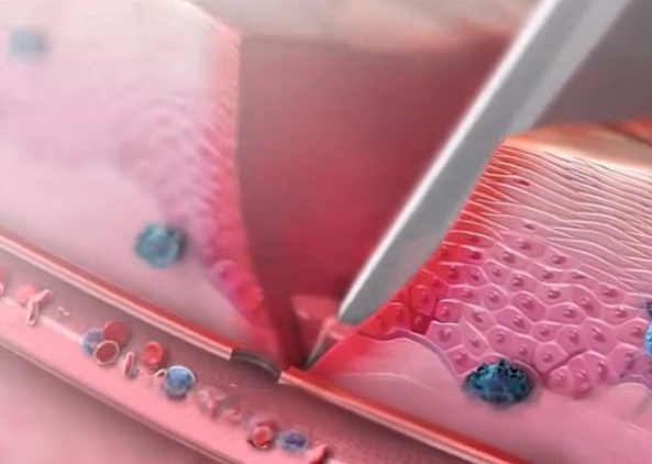 专注病理性瘢痕治疗!新疆威兹曼的 “专而精” 让患者更放心