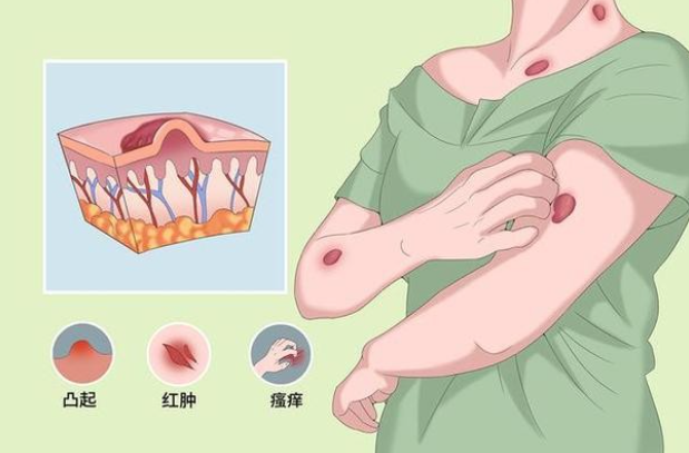 乌鲁木齐增生性瘢痕治疗找哪家?新疆威兹曼高峰医生的诊疗经验很靠谱