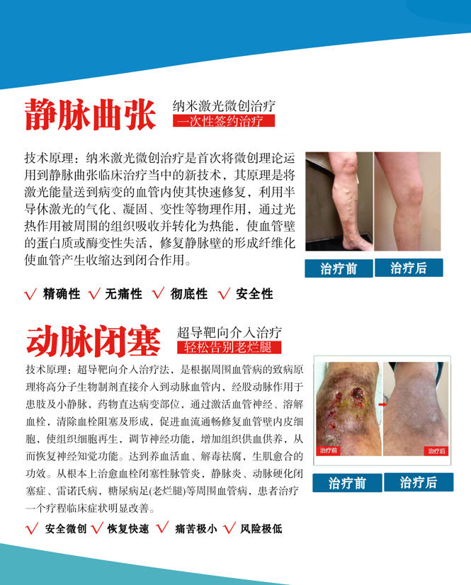 脉管炎反复发作？哈尔滨附三中医院王宝珠有“精准对策”