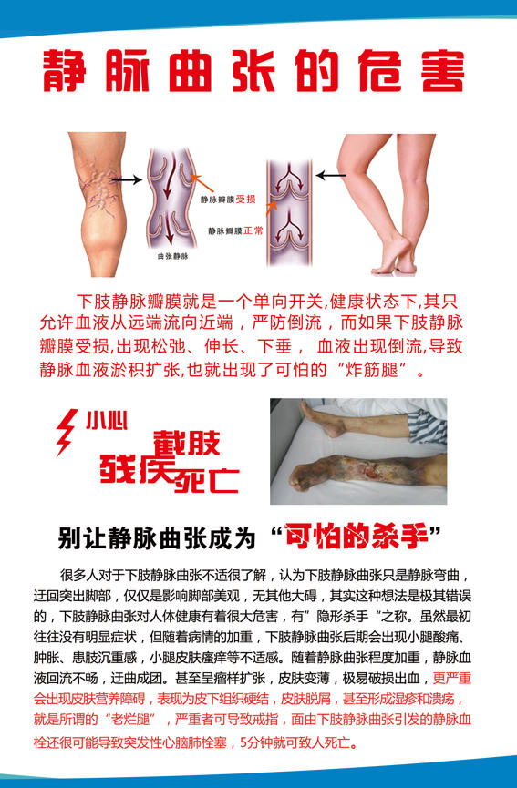 哈尔滨附三中医院王宝珠：深静脉血栓后遗症，别让“老毛病”拖垮生活