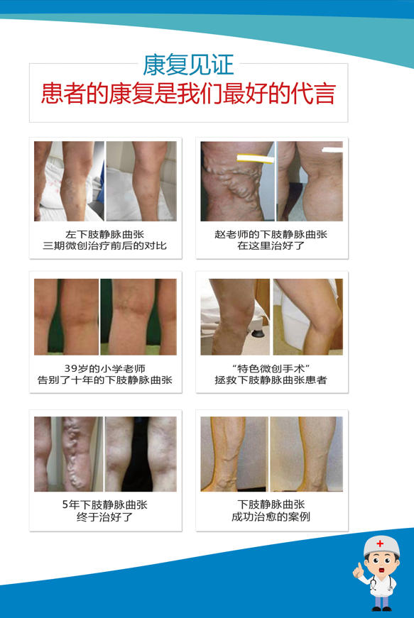 哈尔滨附三中医院徐卫东：让静脉曲张“老烂腿”快速愈合