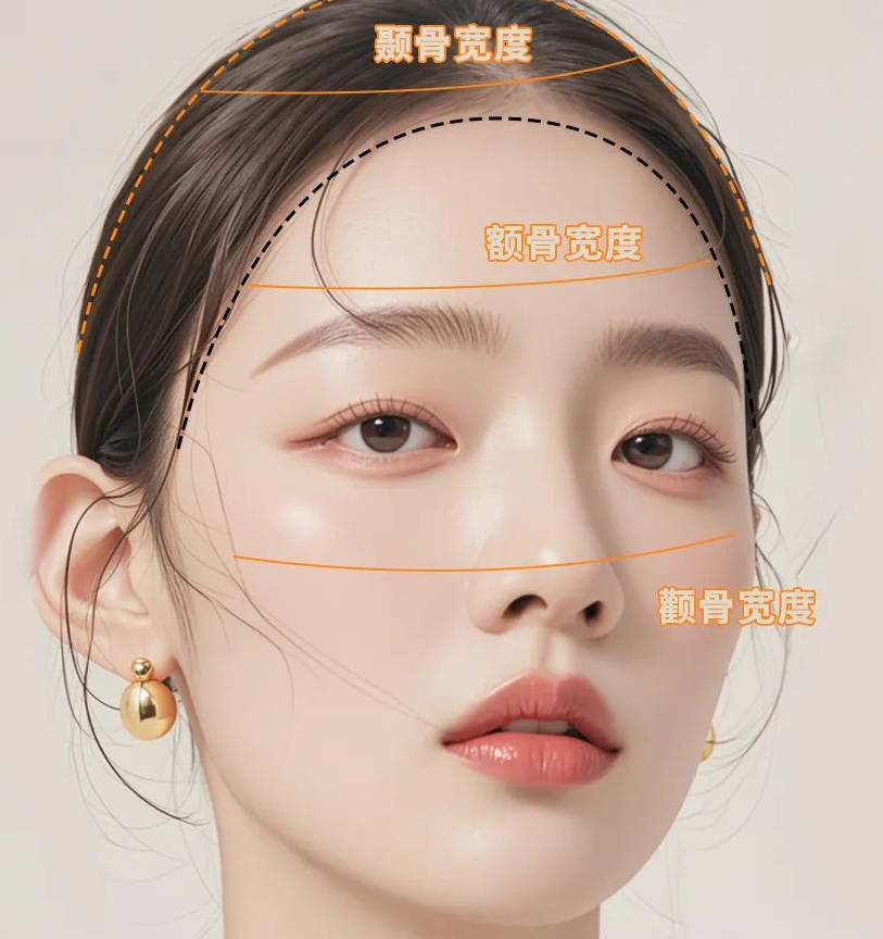 太阳穴凹陷的菱形脸爆改减龄“头包脸”指南，杏林医美