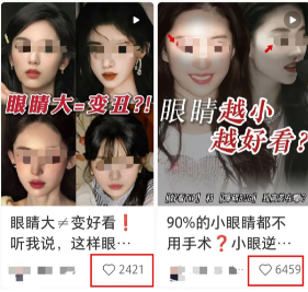 不是越大越好看？原来80%的人都做错，杏林眼综合