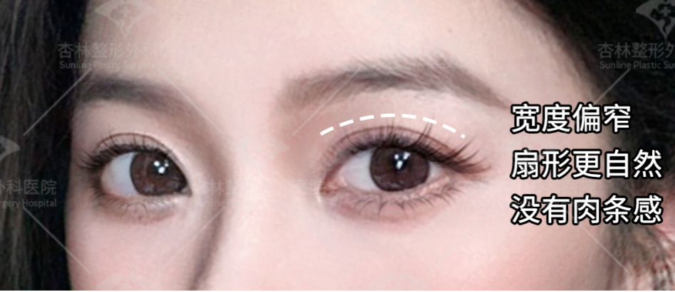 不是越大越好看？原来80%的人都做错，杏林眼综合