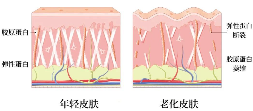 部分都只做了“表面功夫”,那些衰老的慢的人怎么做的,杏林第五代除皱术 部分都只做了“表面功夫”,那些衰老的慢的人怎么做的,杏林第五代除皱术