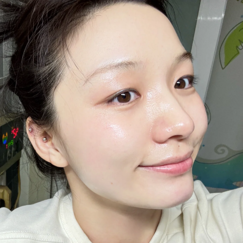 脸上痘痘印变黑怎么办   7 天淡化痘印暗沉，粗糙暗沉全改善