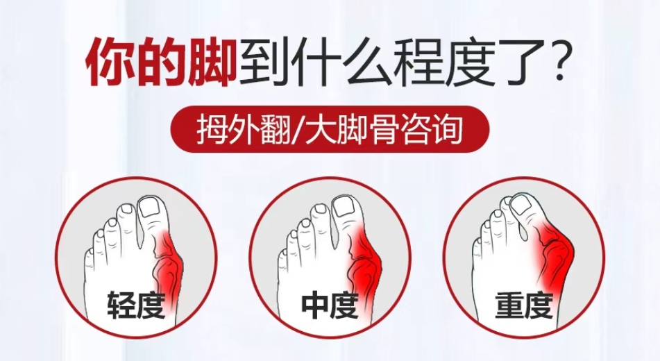 北京国丹医院：治疗拇外翻，微创、超微创、传统手术怎么选？