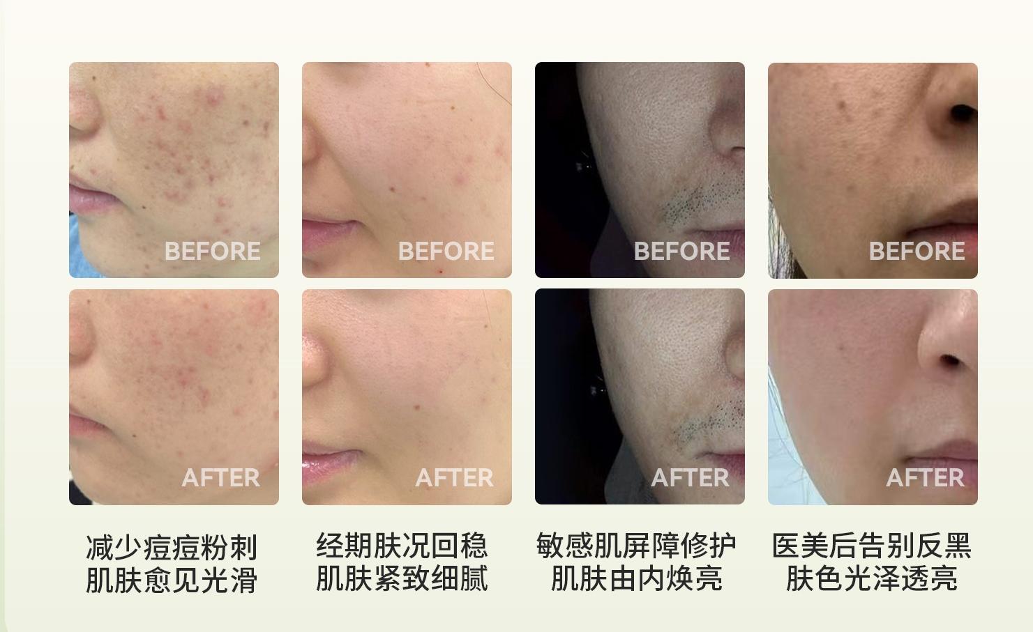 重阳敬老生生纪以AI心探用公益行动让三甲医疗资源走近长者(图14)